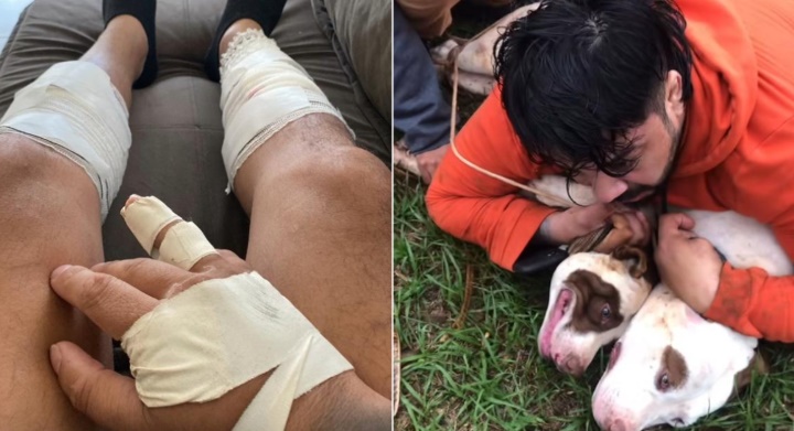Luchador de Muay Thai sobrevive a ataque de Pitbulls
